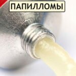 Головная боль в висках и тошнота причины Головная боль в висках и тошнота причины