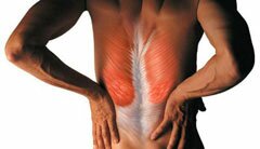Миозит спинных мышц